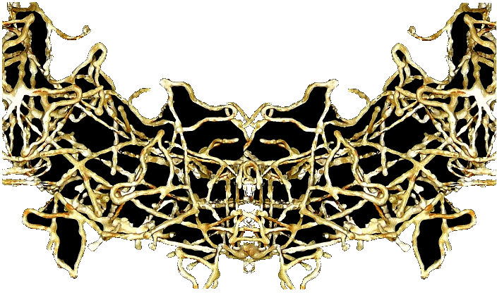 metal wreath